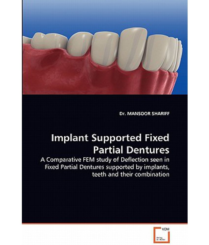 Implant Supported Fixed Partial Dentures Buy Implant Supported Fixed