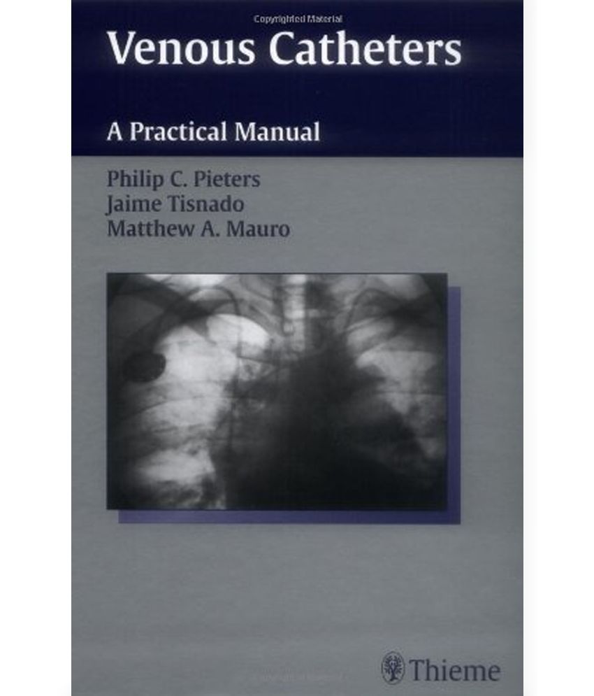 Venous Catheters Buy Venous Catheters Online at Low Price in India on