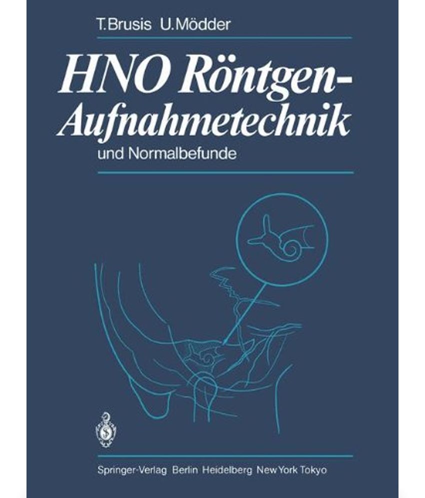 HNO R NTGEN AUFNAHMETECHNIK UND NORMAL: Buy HNO R NTGEN AUFNAHMETECHNIK ...