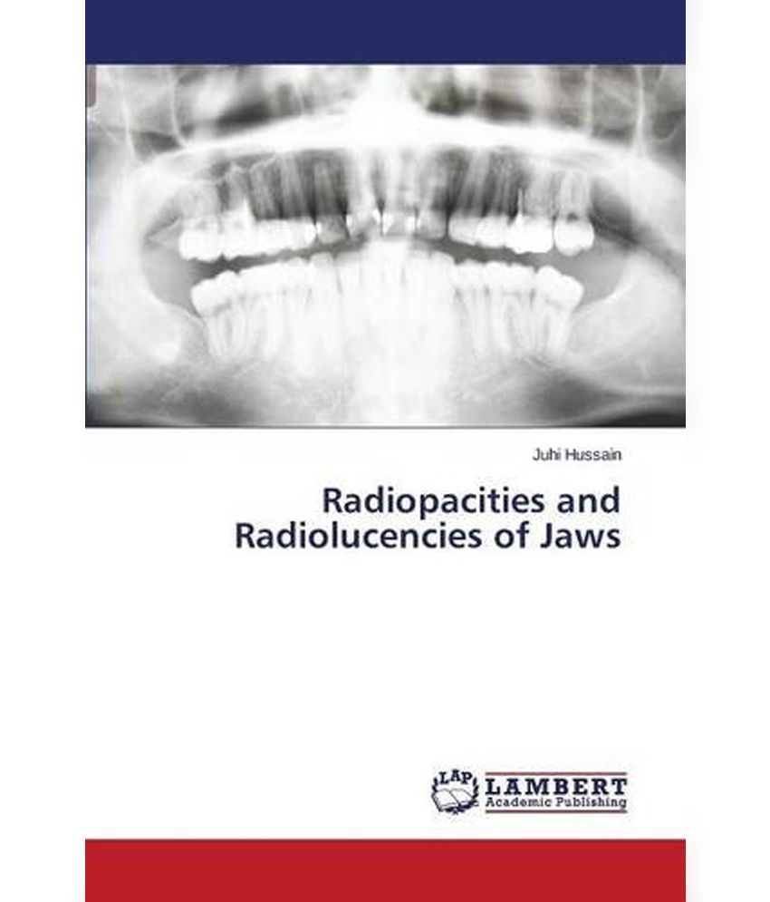 Radiopacities and Radiolucencies of Jaws: Buy Radiopacities and ...