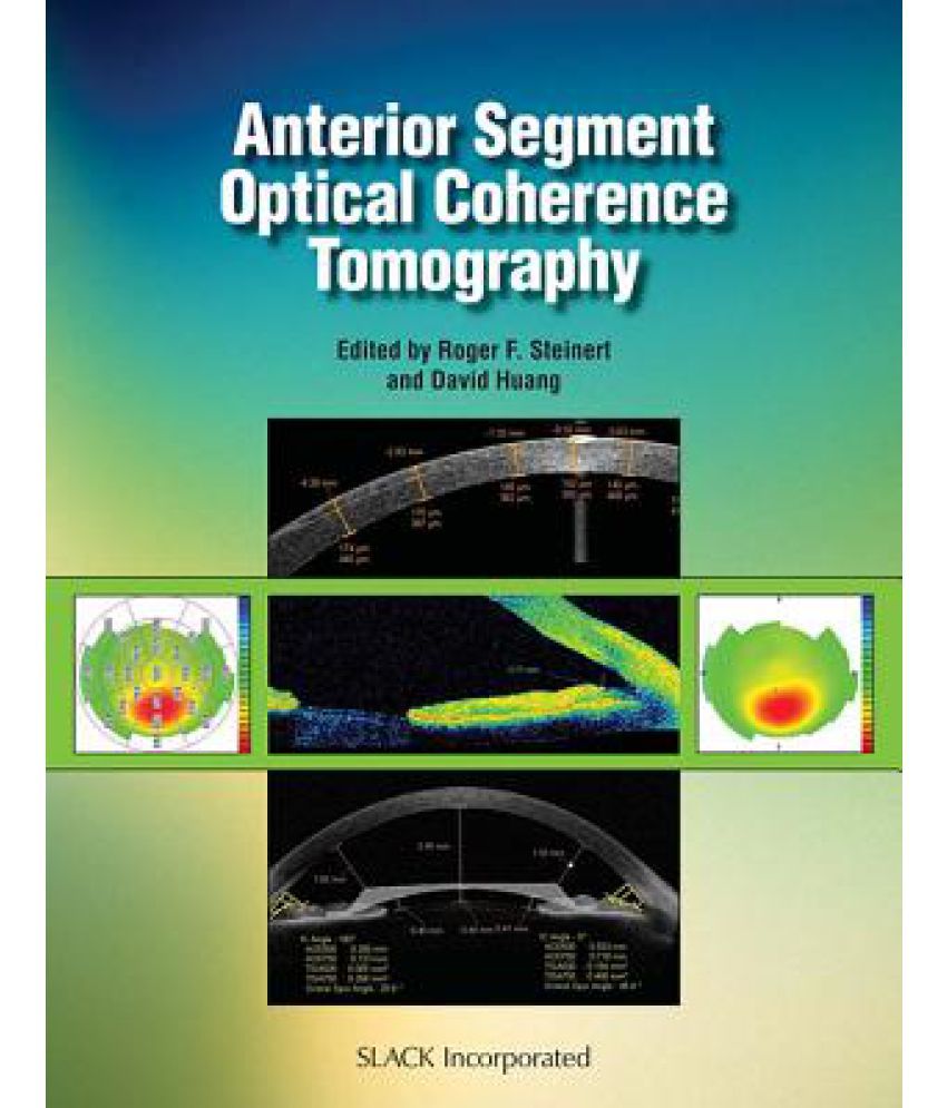 Anterior Segment Optical Coherence Tomography Buy Anterior Segment