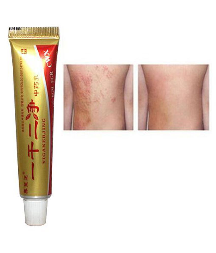 Natural Mint Psoriasis Eczema Ointment Creams Antibacterial Dermatitis