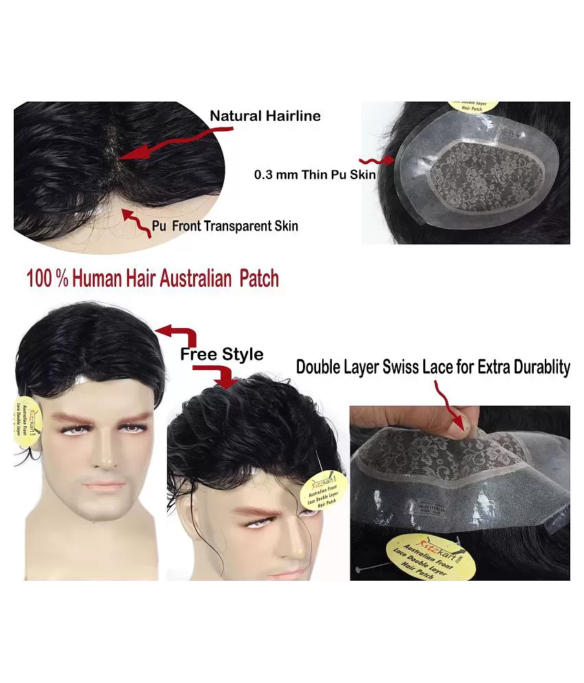 Front Lace Polyfuse Hair Patch  Face Looks Hair Clinic in Noida