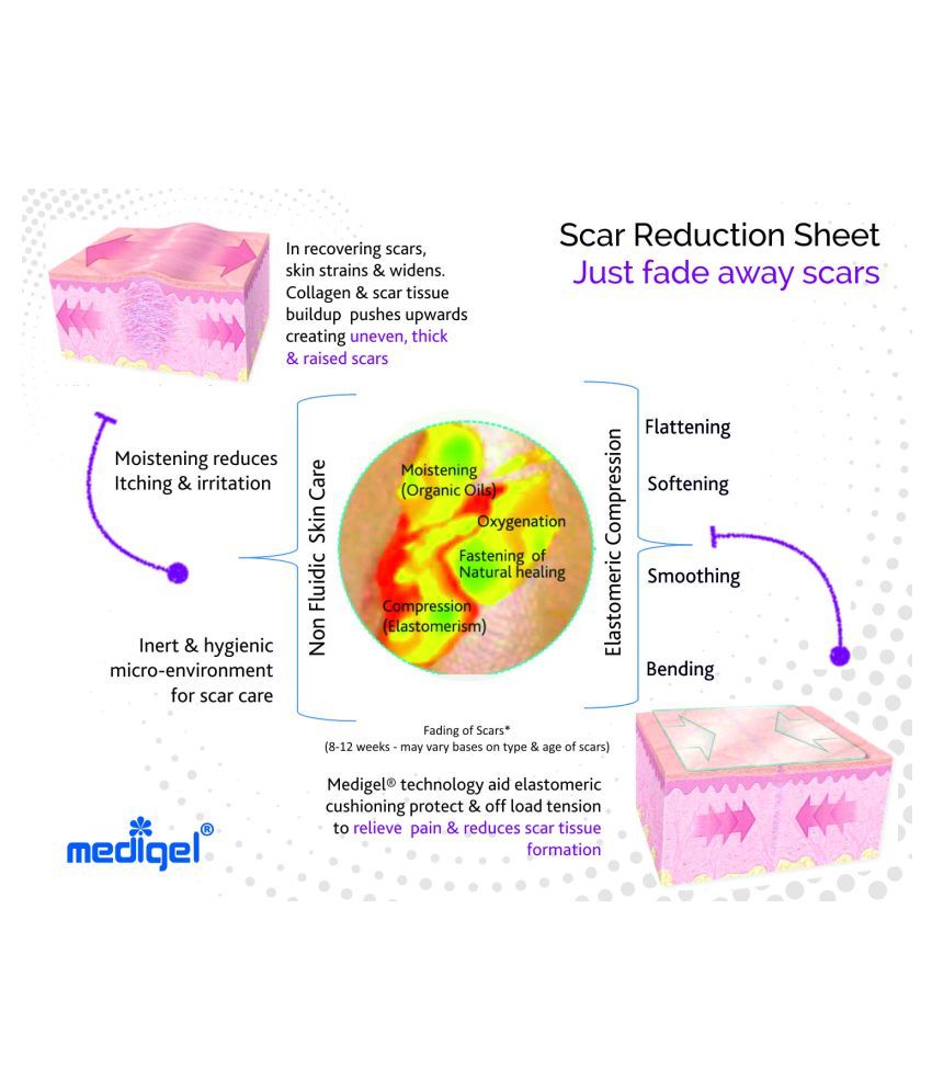 Medigel Magic Scar Reduction Sheet 2"X2" Magic Scar Gel Sheet Pack Of 1