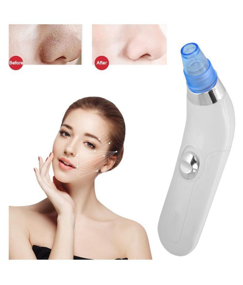 SJ Facial Pore Cleanser Vacuum Suction Blackhead Whitehead Remover Buy