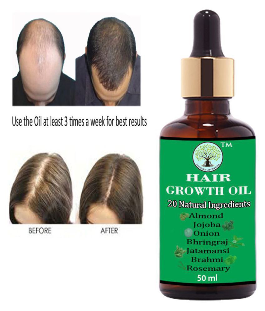 MODERN AYURVEDA Hair Growth Oil with Onion Bhringraj - Hair fall ...