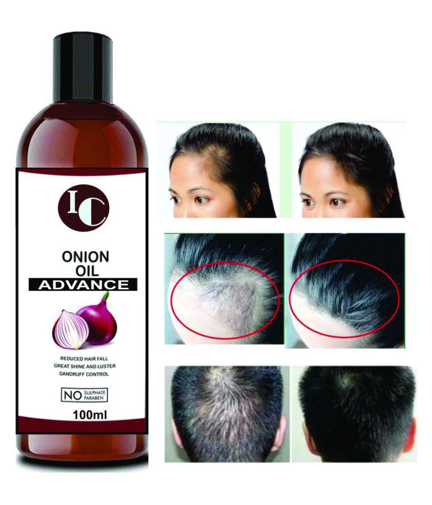 INDO CHALLENGE Onion Oil for Hair Growth & Control with Redensyl 100 mL