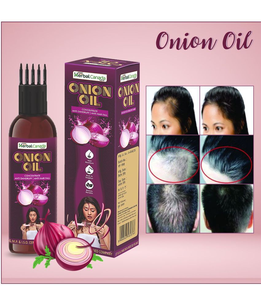 Herbal Canada Onion Hair Oil | for Hair Growth Oil 100 ml Pack Of 1