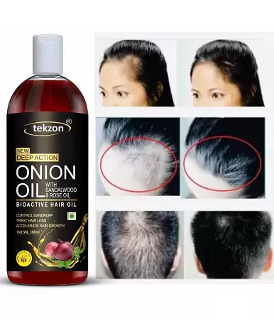 Hairfall and Dandruff Synthetic Onion Hair Oil