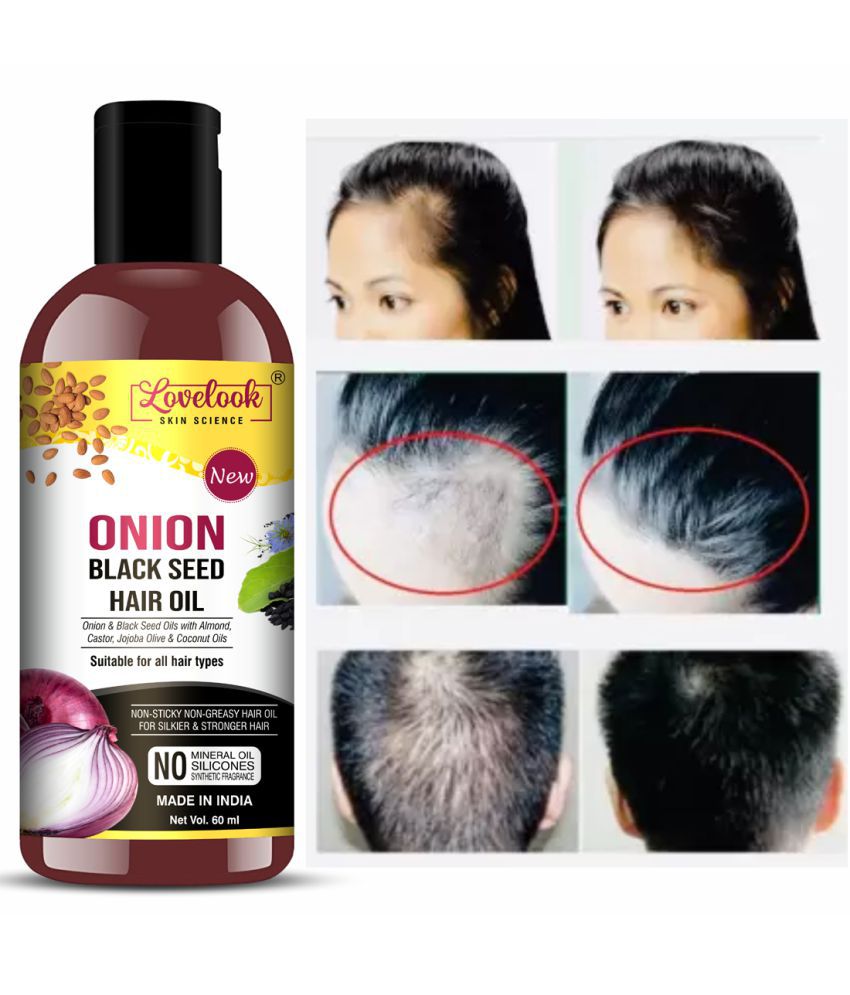    			Lovelook Onion Oil for Hair Growth 60 mL