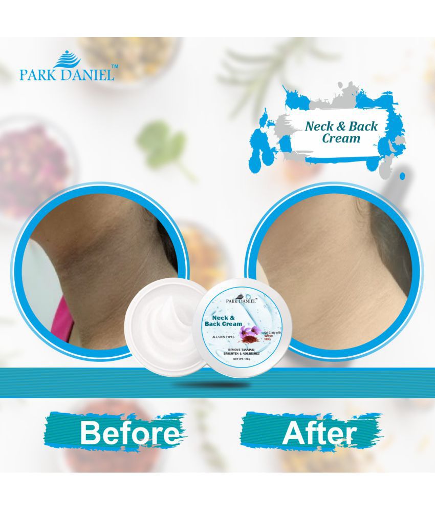     			Park Daniel Neck & Back Whitening Cream For All Skin Types Pack of 1 of 100 Grams