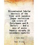 Disseminated lobular necrosis of the liver with jaundice (hepar necroticum cum ictero of Curschmann and H. Oertel) : And a case of acute h [Hardcover]