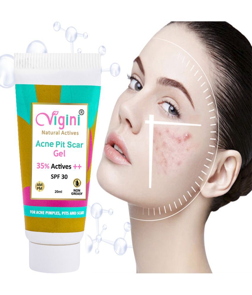     			Vigini 35% Actives Anti Acne Pits & Scars Stop Spot Face Gel 20ml | Reduce Redness Remove Pimples Treatment Prone Skin for Men Women Removes Acne, Pimples Control Day Moisturizer Provides SPF30 Cream Gel Facial Kit Pack Soap Scrub Free Wash Tea Tree Oil