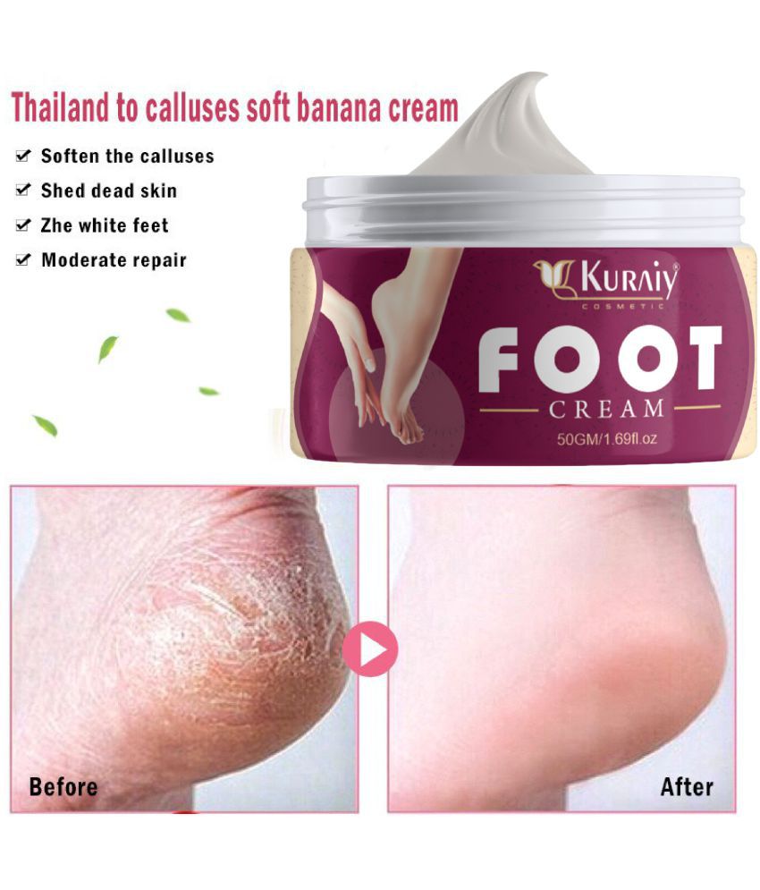     			Kuraiy Foot Corn Remover Cream , For Dry Hard Cracked Heel Skin Repair Feet Care Men And Women.