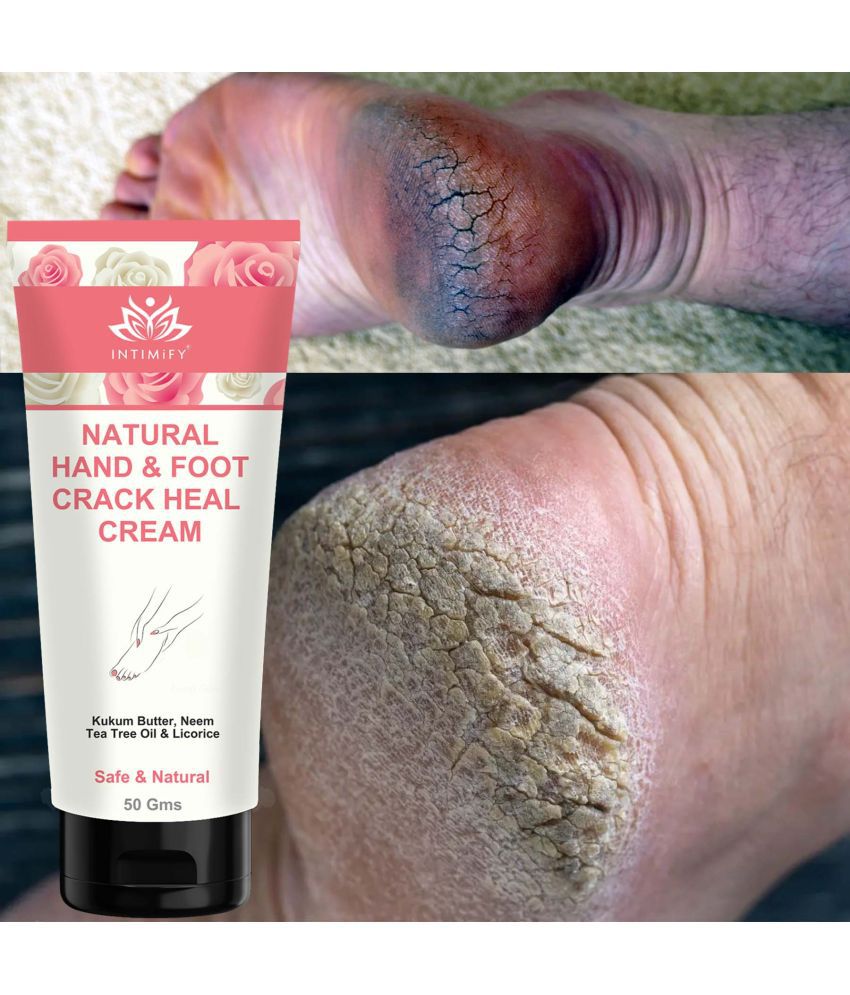 Intimify Foot Cream, Crack Cream Foot Crack Cream Foot Cream ( 50 g )