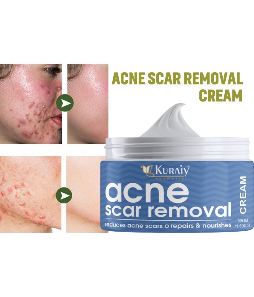     			KURAIY Acne Face Cream Herbal Pimple Scar Removal Shrink Pore Oil Control Facial Cream