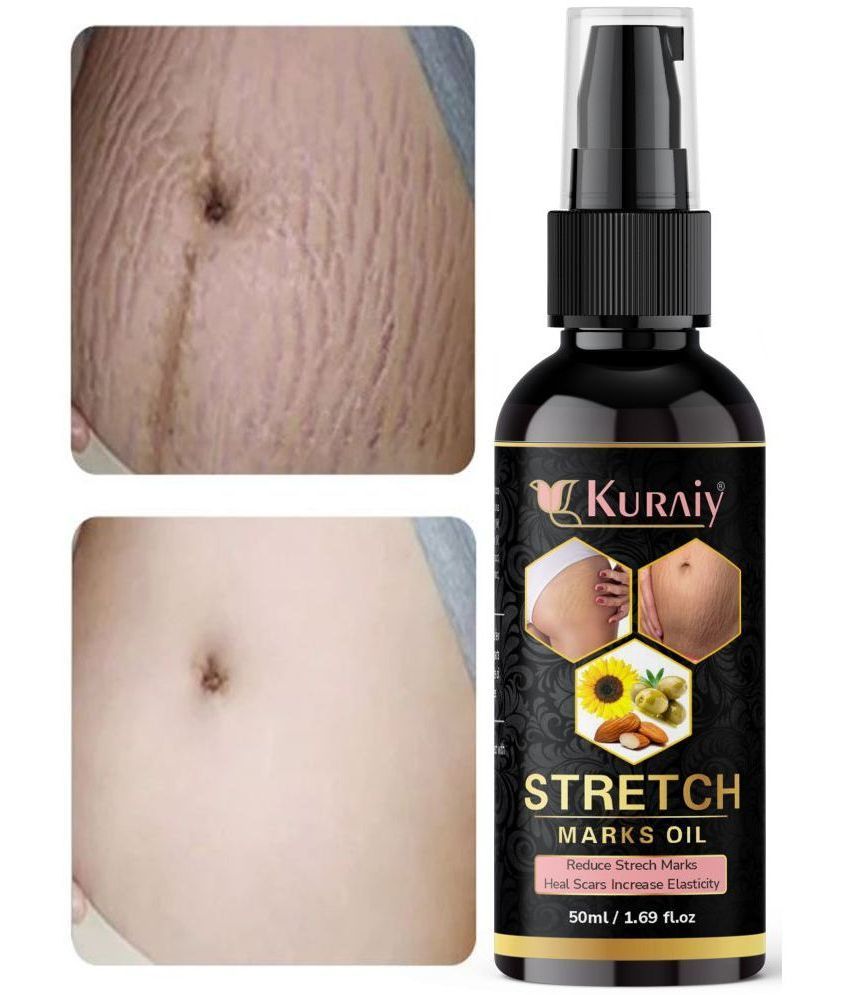     			KURAIY Remove Pregnancy Mark Body Cream Treatment Scars Acne Stretch Marks Cream