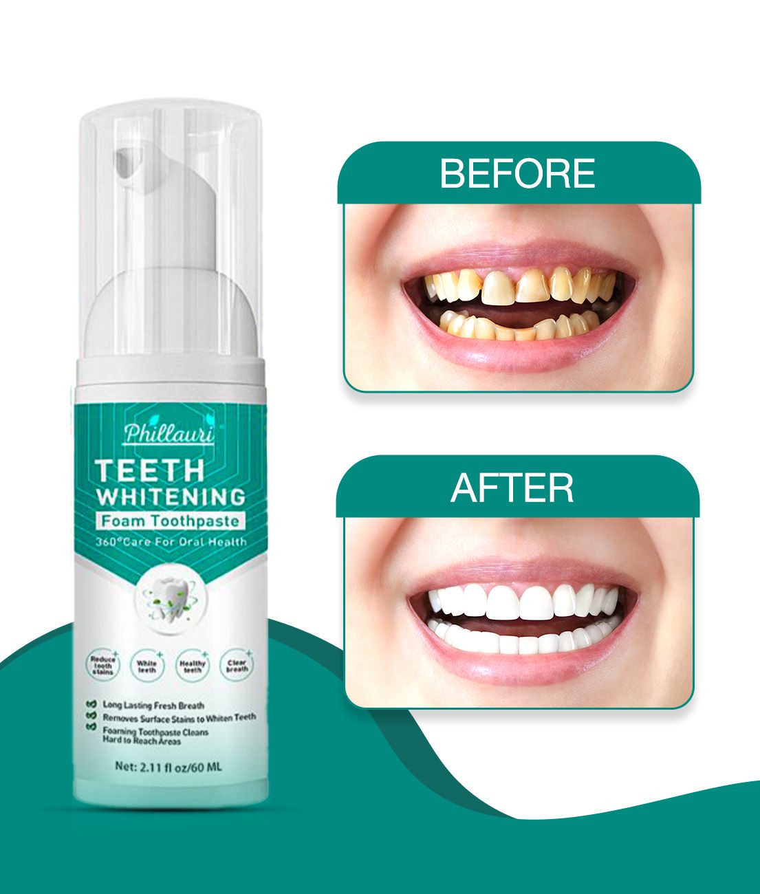     			Phillauri Teeth Whitening Denture Oral Kit