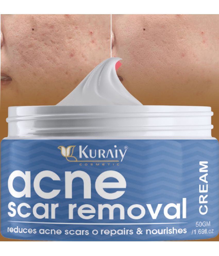     			KURAIY Acne Face Cream Herbal Pimple Scar Removal Shrink Pore Oil Control Facial Cream