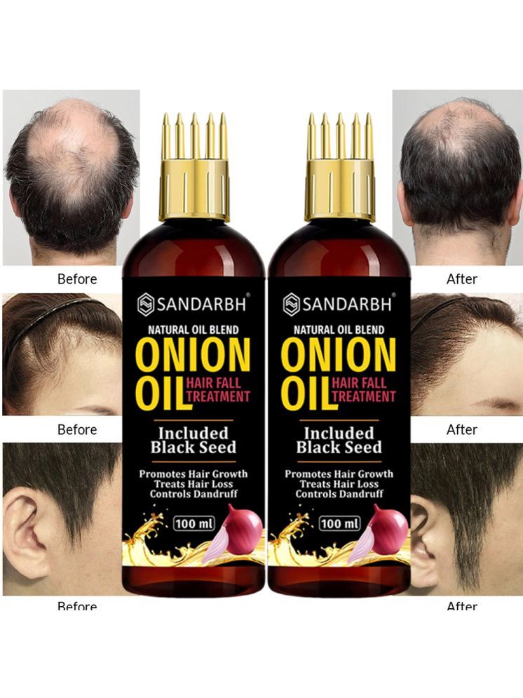     			Sandarbh Anti Hair Fall Onion Oil 100 ml ( Pack of 2 )