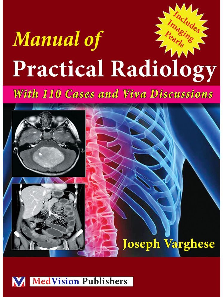     			Manual of Practical Radiollogy With 110 Cases and Viva Discussions