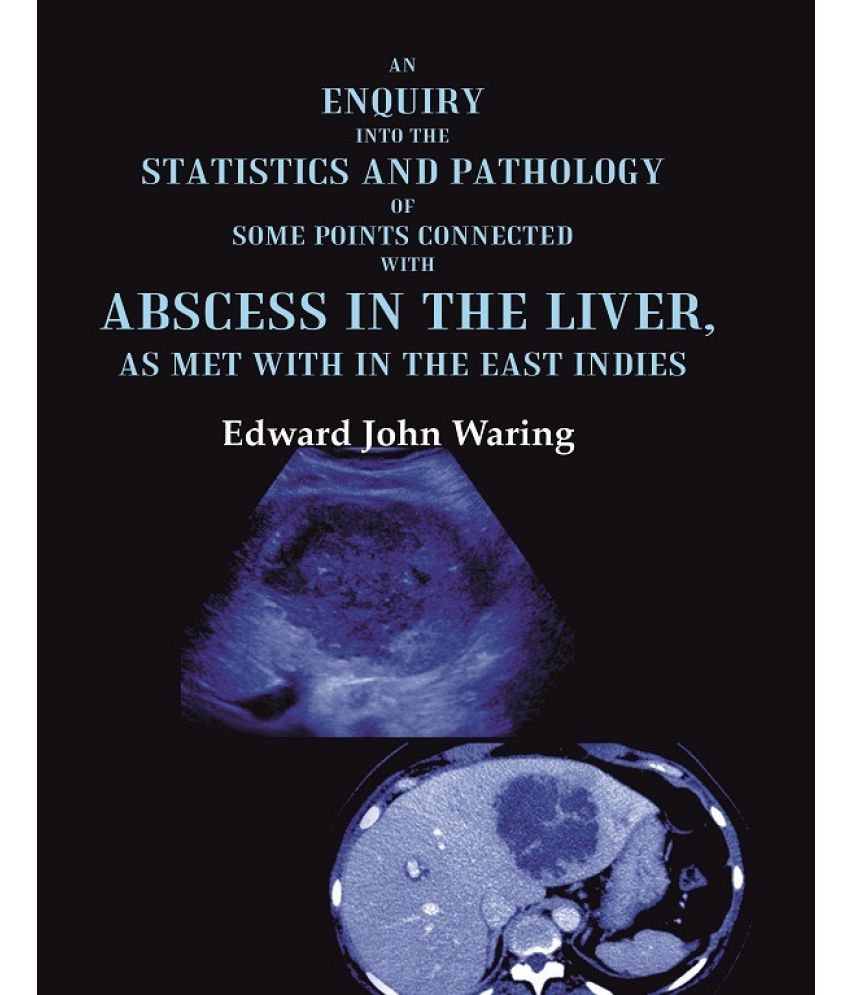     			An Enquiry into the Statistics and Pathology of Some Points Connected with Abscess in the Liver, as Met with in the East Indies [Hardcover]