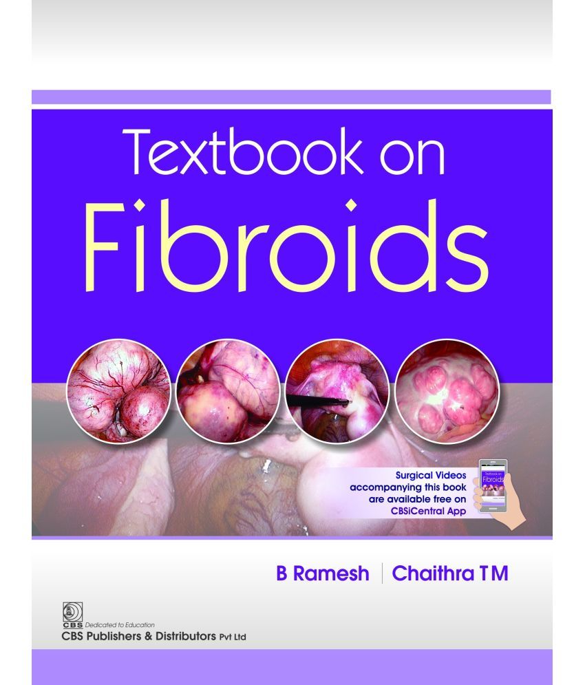     			Textbook on Fibroids