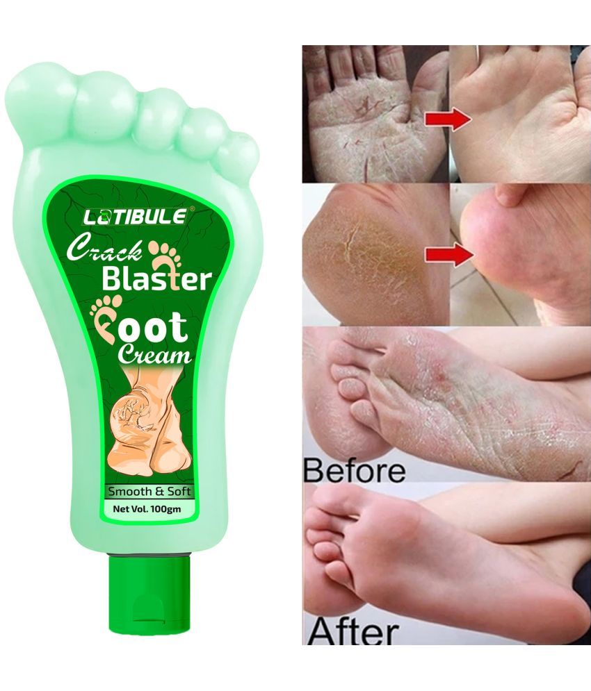     			Latibule Anti Itch Crack Blaster Foot & Hand Cream For Soft & Smooth Skin, 100 ml, pack of 1