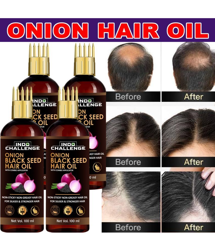     			INDO CHALLEGE Anti Dandruff Onion Oil 100 ml ( Pack of 4 )