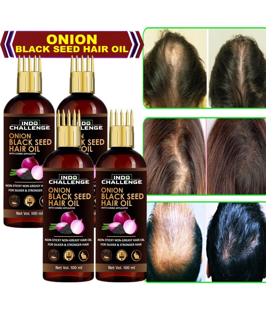     			INDO CHALLEGE Anti Dandruff Onion Oil 100 ml ( Pack of 4 )