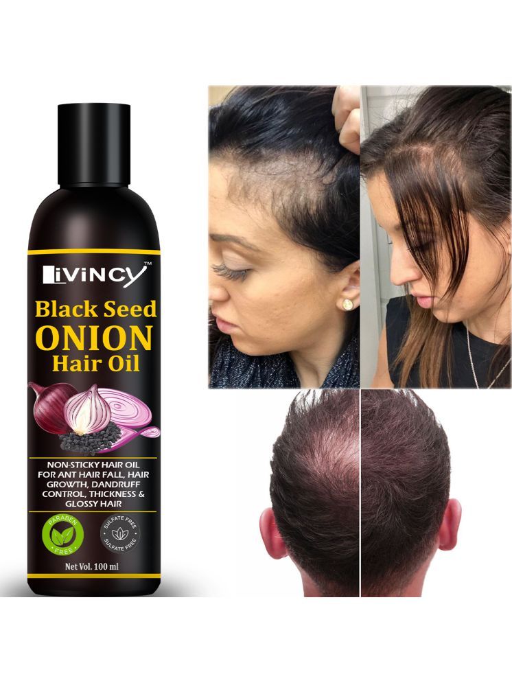     			LIVINCY Hair Growth Onion Oil 100 ml ( Pack of 1 )