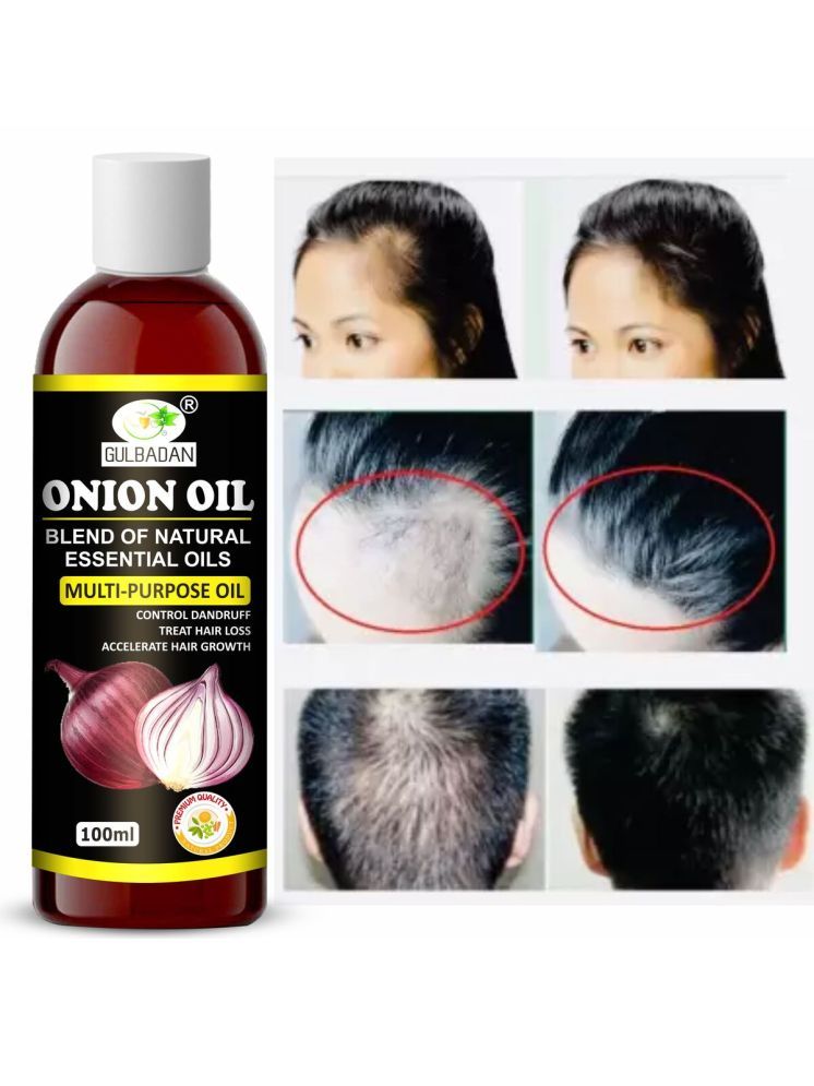     			GULBADAN Anti Dandruff Onion Oil 100 ml ( Pack of 1 )